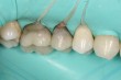 Alcune nostre realizzazioni - 3D Tecnologie Dentali