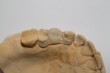 Alcune nostre realizzazioni - 3D Tecnologie Dentali