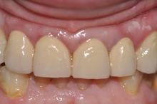 tradizione... - 3D Tecnologie Dentali